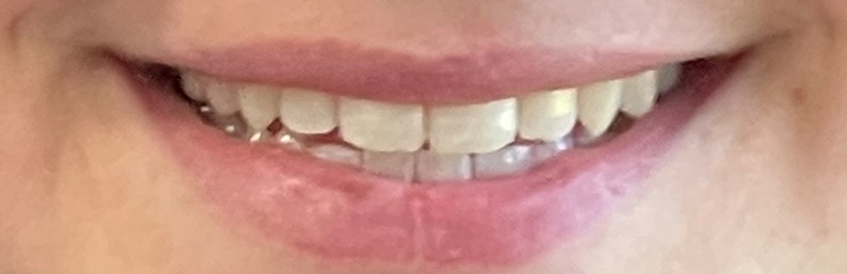 After
